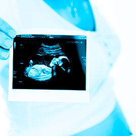Unsafe Abortions